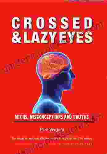 Crossed And Lazy Eyes: Myths Misconceptions And Truths